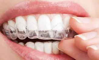 成年人可以矫正牙齿吗 西安雅至口腔牙齿矫正的黄金期