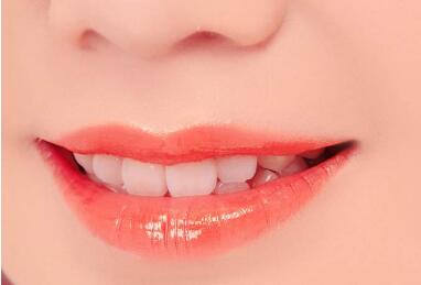 上海圣贝<font color=red>口腔整形</font>医院整个种植牙完成时间需要多久