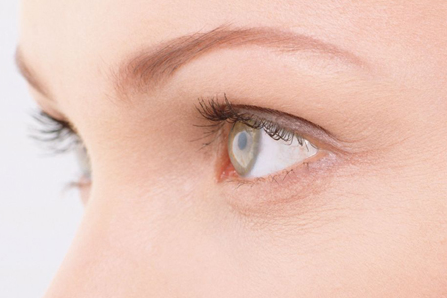 埋线法双眼皮手术 高分子蛋白线 疤痕体质能做吗