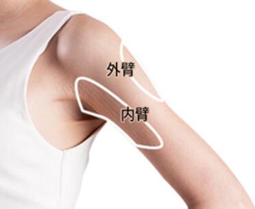 武汉锦颜秀整形医院手臂吸脂有哪些优势  多久可消肿