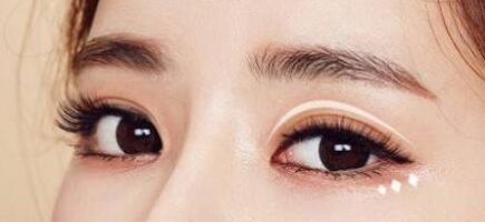 韩式双眼皮是永久的 武汉民生五官医院2020价格表