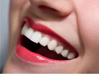西安莲湖圣贝<font color=red>口腔整形医院</font>牙齿矫正多少钱 牙齿更加整齐