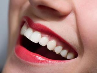 广州德伦口腔医院<font color=red>美容冠牙齿矫正</font> 拥挤前突的黄牙变得整齐
