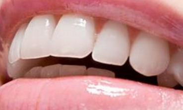 深圳罗湖区口腔整形医院做种植牙痛不痛呢 可以维持多久