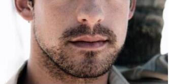 南京华美医院植发科胡须种植术 彰显更多的男人味