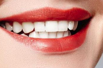 地包天牙齿要怎么矫正 重庆牙博士口腔医院可以矫正吗