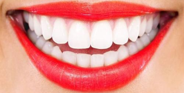 冷光牙齿美白多少钱 哈尔滨美联致美冷光牙齿美白永久吗