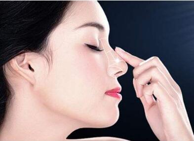 深圳阳光整形医院鼻尖整形术的优势有哪些 为你的美丽加分