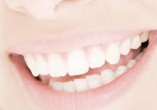 安徽合肥贝杰口腔牙齿美容冠 让你的牙齿整齐又洁白