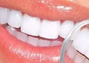 郑州天后医院口腔科烤瓷牙修复的特色有哪些 烤瓷牙效果