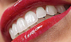 武汉大众口腔门诊部<font color=red>牙齿矫正的效果</font> 牙齿矫正年龄