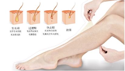 北京做小腿激光脱毛需要多少钱 小腿脱毛展现您的光滑美腿