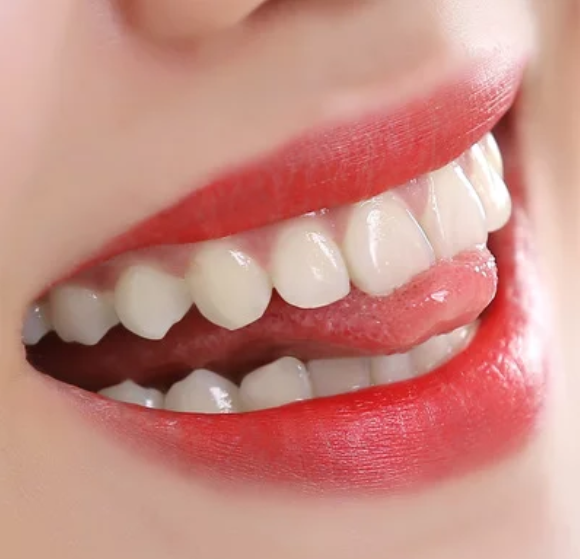 <font color=red>牙齿矫正的方法</font>有哪些 广州牙齿矫正贵吗