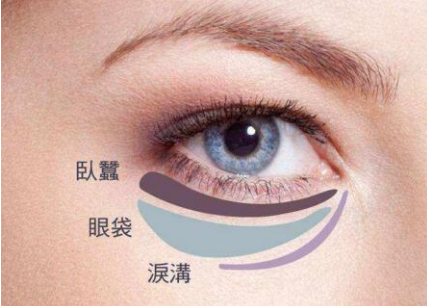 上海美未央整形医院<font color=red>激光祛眼袋价格</font> 助您摆脱讨厌的眼袋