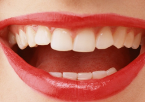 上海华尔康口腔门诊部种植牙过程 能使用多长时间
