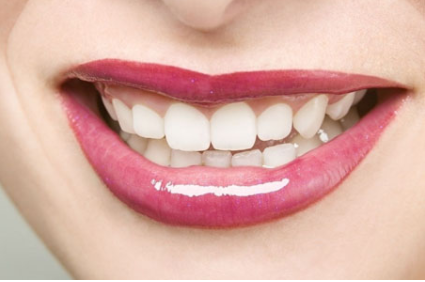 深圳弘和<font color=red>口腔种植牙</font>齿多少钱 种植牙有哪些优点