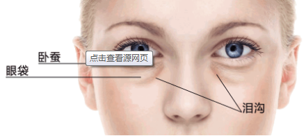 重庆祛眼袋医院哪家好 激光去眼袋效果能长久吗