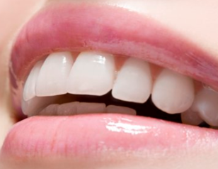 呼和浩特至美口腔门诊部牙齿矫正的好年龄 不仅是为了美观