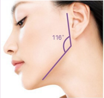 上海下颌角整形多少钱 告别宽大的下颌角 让您秒变精致小脸