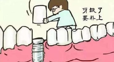 拔牙后多久可以去做种植牙 北京种植牙报价