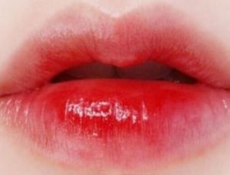 白山汉诚整形医院<font color=red>漂唇</font>术效果如何 拥有红润的唇色