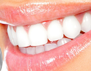 种植牙术后怎么护理 北京合众齿科门诊部种植牙有什么优点