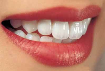 北京烤瓷牙让您轻松拥有整齐洁白的牙齿 告别大黄牙