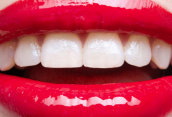上海摩尔口腔医院全瓷牙的种类有哪些？<font color=red>烤瓷牙</font>术后保护