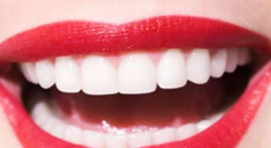 北京做烤瓷牙价格是多少 整洁的牙齿让您的笑容更自信