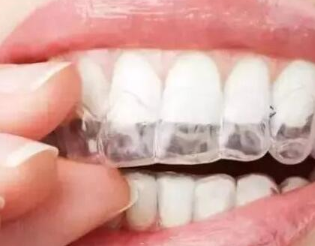 合肥美奥口腔整形医院牙齿矫正手术方式 价格是多少
