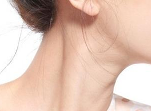 颈部祛皱哪种方法好 兰州三爱整形医院激光除皱多少钱