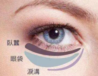 北京联合丽格刘越做去眼袋效果好吗 激光<font color=red>手术去眼袋的价格</font>
