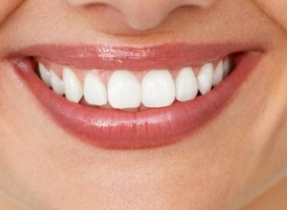 <font color=red>牙齿矫正的好处</font> 苏州牙博士牙齿矫正让你的牙齿整齐又健康