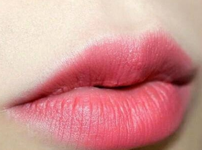 西安做厚唇改薄多少钱 让您拥有美观性感的嘴唇