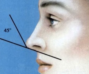 什么是鼻部再造 温州乐清顾得美整形医院鼻部再造术过程