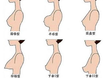 广州瑞港整形门诊部乳房下垂矫正术维持多久 会有疤痕吗