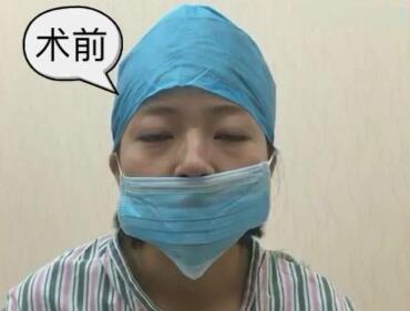 武汉亚太整形医院歪鼻矫正优势有哪些 有危害吗