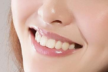 牙齿矫正的年龄 深圳阳光口腔门诊部牙齿矫正价格
