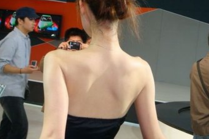 北京杏林美整形诊所背部吸脂手术如何 术后对人体有影响吗
