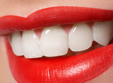 牙齿不齐 北京西诺口腔门诊部牙齿矫正有危害吗