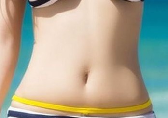 广州海峡整形医院闫爱跃腰腹部吸脂减肥恢复快 不反弹