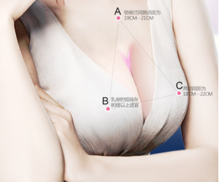 杭州时光整形医院巨乳缩小术的切口在哪 术后乳房依旧挺拔