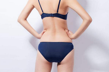 北京凯润婷医疗美容整形臀部吸脂效果如何 恢复期长吗