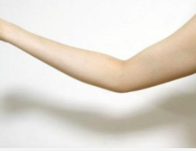 上海丽质整形医院手臂吸脂的方法有几种 远离蝴蝶袖