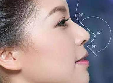 深圳美莱整形医院李占强自体软骨隆鼻 塑造自然鼻型
