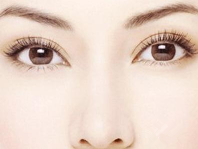 双眼皮修复需要多少钱 杭州吉奥整形医院修复方案