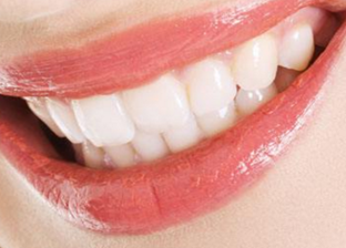 秦皇岛港口医院美容牙齿矫正有危害吗 优势有哪些