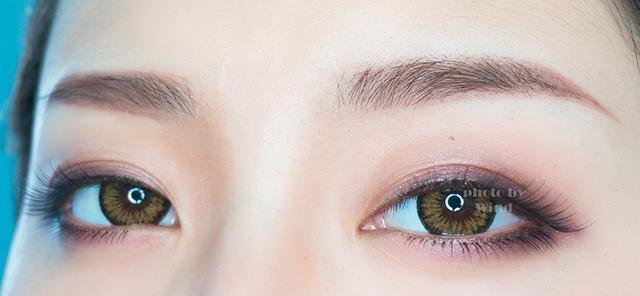 洛阳亚峰整形医院提眉手术有几种做法 效果能保持多久