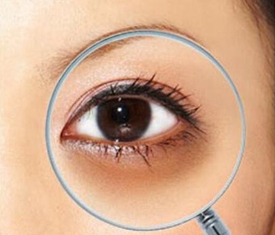 长沙晶肤整形医院去黑眼圈方法有哪些 激光去黑眼圈优势