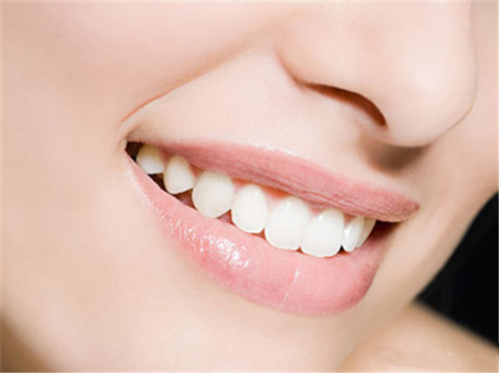 怎么能美白牙齿 北京德贝口腔医疗做冷光美白作用原理